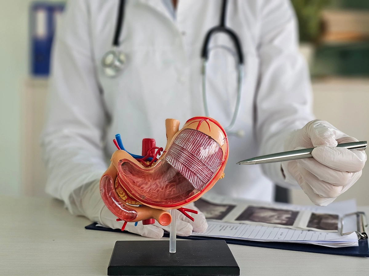 A doctor pointing to an anatomical diagram of a stomach