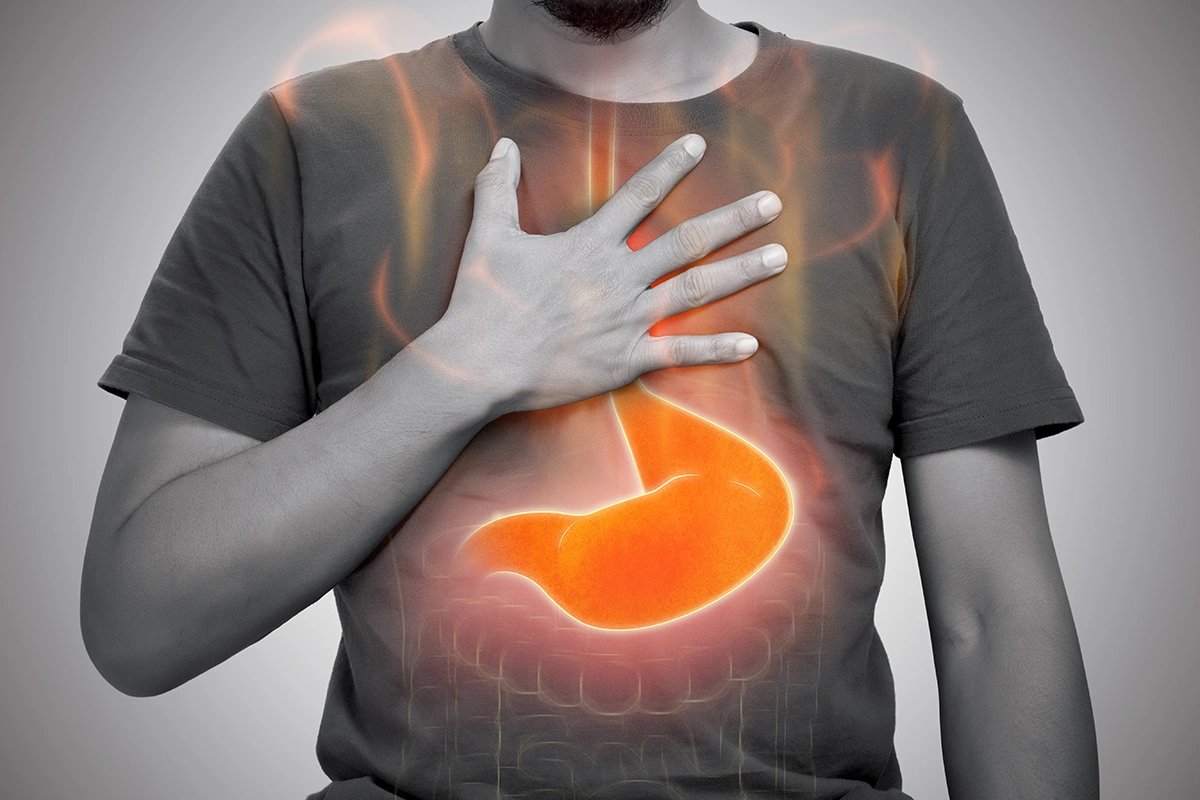 Most Common Symptoms of Gastroesophageal Reflux Disease