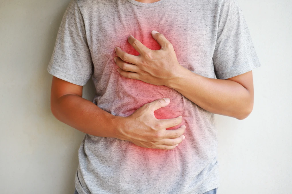 Is Acid Reflux, Heartburn, Gastric Reflux & GERD the Same?