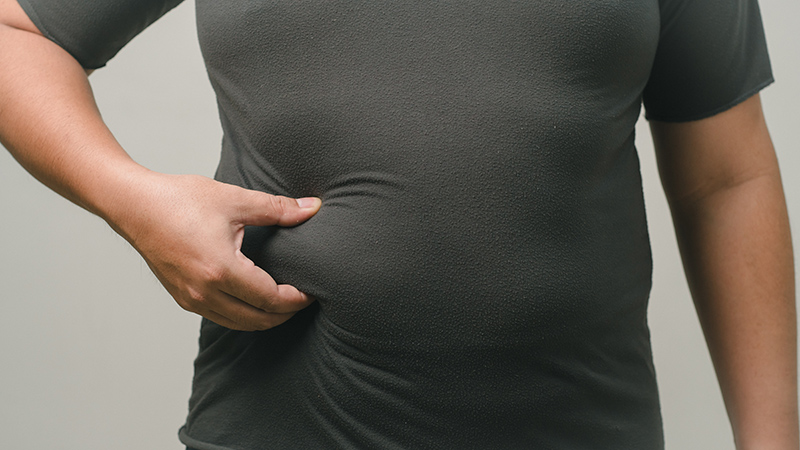 Man with obesity pinching excess abdominal fat around his stomach