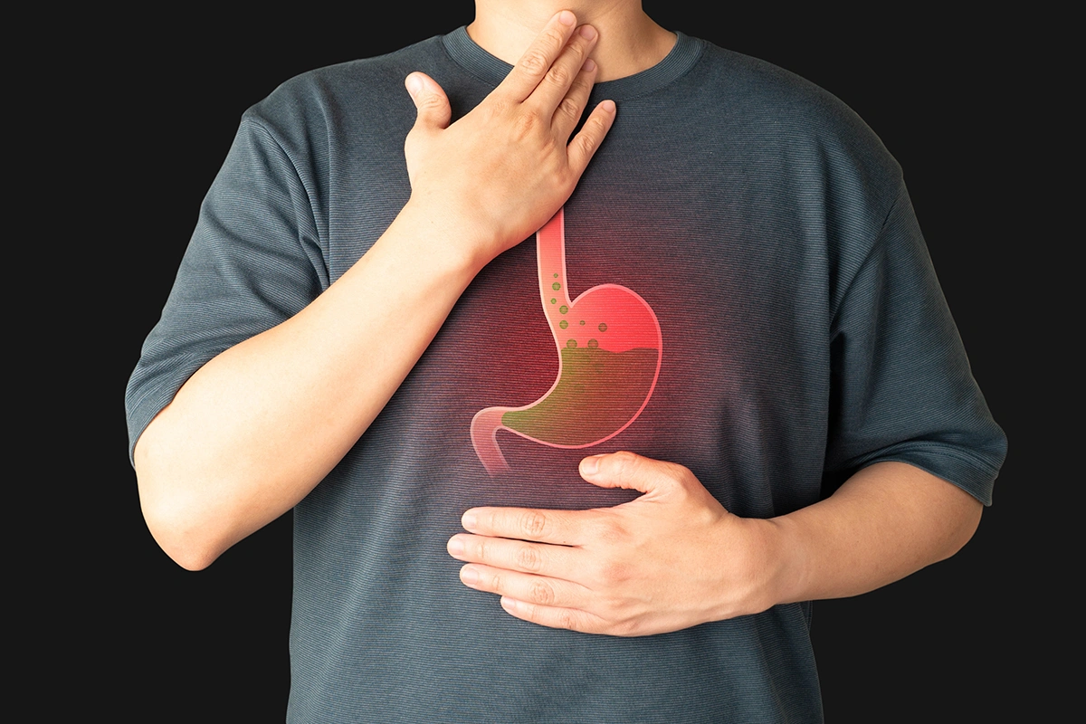 When Acid Reflux Becomes GERD: Signs It’s More Serious
